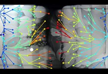 Бактериялар біз ойлағаннан да әлдеқайда төзімділігін шапшаң қалыптастыруда