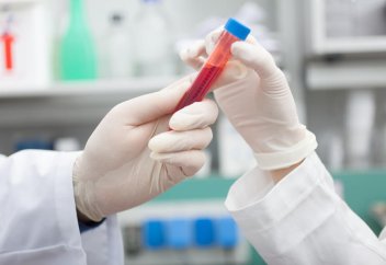 Араб ғалымы қанды тамыр ішінде тазалайтын құрылғы ойлап тапты