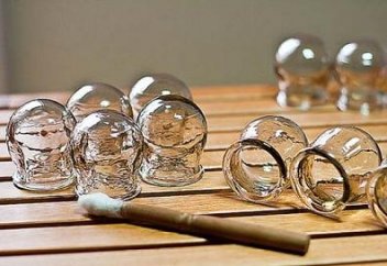 Хиджама ем түрінің қалай жүргізілетінін ДСМ қадағалай алмай отыр