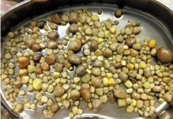 Денсаулық: Қытайлық науқастың бүйрегінен 420 тас шықты