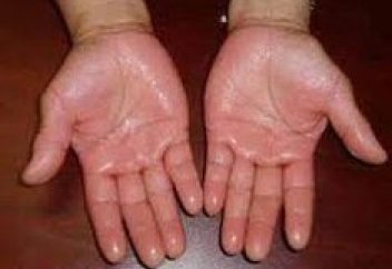 Алақанның терлеуі неден дерек береді?