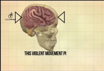 Вот почему Пророк Мухаммад (ﷺ) запрещал бить кого-либо по лицу (видео)