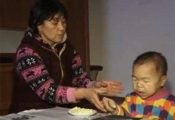 Қызылорда облысында өте сирек кездесетін ауруға шалдыққан жігіт тұрады