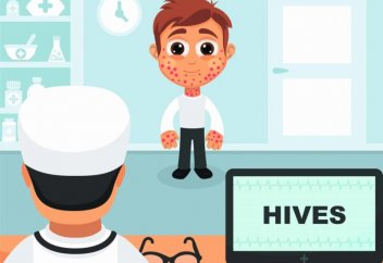 Аллергияның кеңінен тараған түрін қалай анықтауға және емдеуге болады?