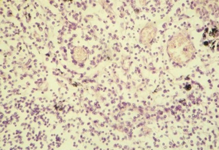 В крови человека нашли неизвестные организмы