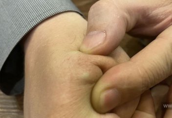 Первый чипированный кыргызстанец рассказал о своем опыте (фото+видео)