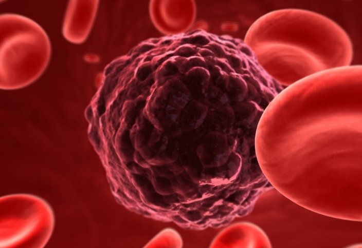 Разработан новый способ лечения рака крови
