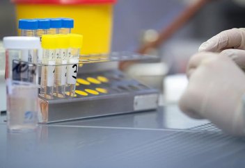 Ученые выяснили, когда впервые произошла вспышка коронавируса