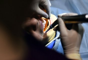 Бесплатное лечение зубов в Казахстане: кто и как может получить услугу