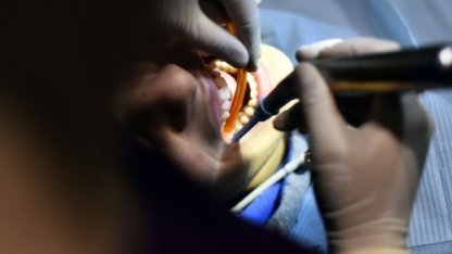 Бесплатное лечение зубов в Казахстане: кто и как может получить услугу