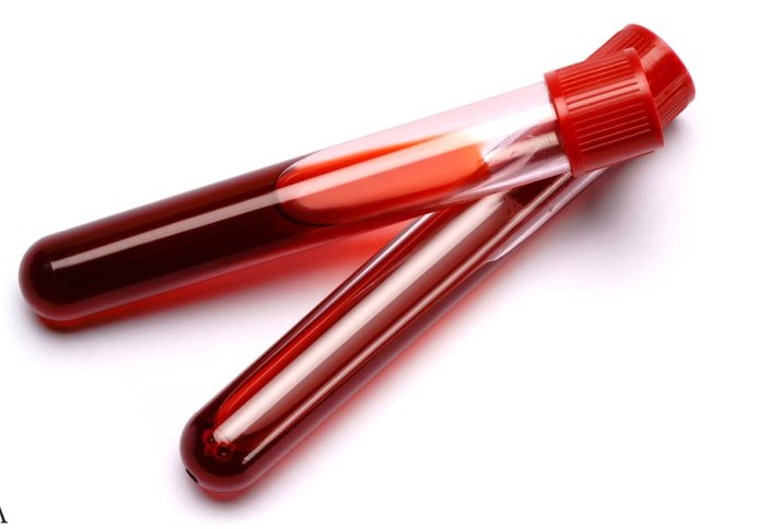 Қан тапшылығын жоятын технология пайда болды