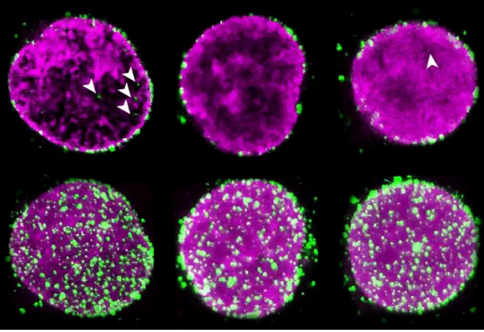 Аса қауіпті вирустың адам жасушасын қалай жаулап алатынын таспаға тартылды (видео)
