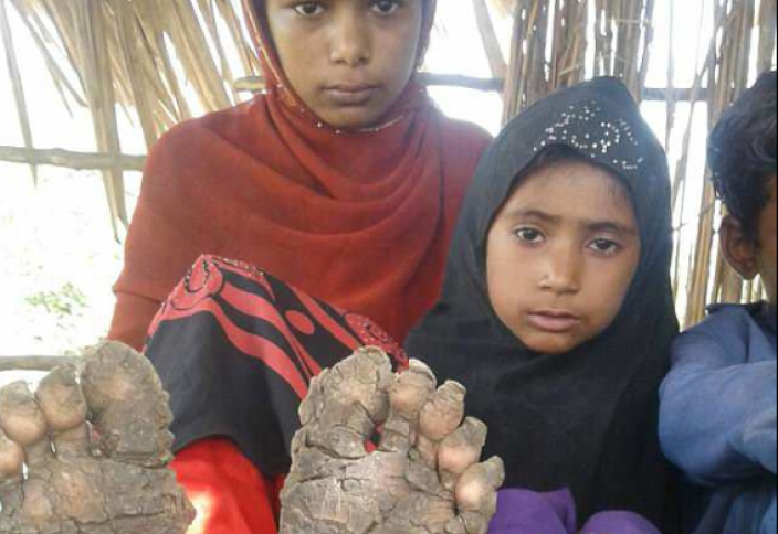 Четверо детей из мусульманской семьи превращаются в камень