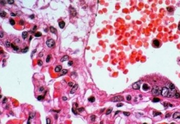 Адамды өлімге алып келетін өте қауіпті вирус тіркелді