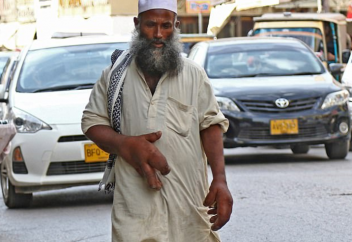 Мусульманин с тяжелой аномалией не теряет веру в Аллаха