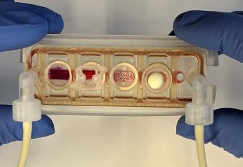 Бір чипке өзара байланысты бірнеше ағзаны сыйдырды