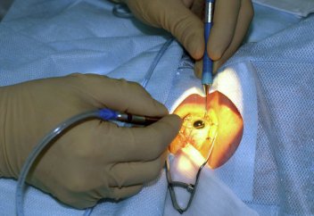 Биологтар соқырлықты емдеу үшін көз торының жасушасын жасауды үйренді