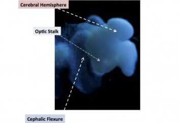 АҚШ ғалымдары тұңғыш рет адам миын өсіріп шығарды