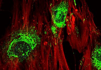 Ғалымдар діңгекті жасушаларды дыбыстың көмегімен сүйекке айналдырды