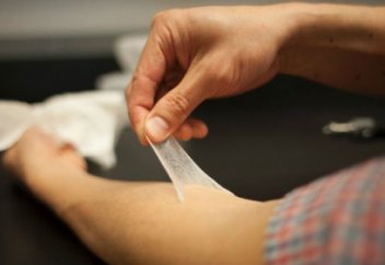 Ақтөбеде күйіктің тез жазылуы үшін жасанды тері қолданыла бастады (видео)