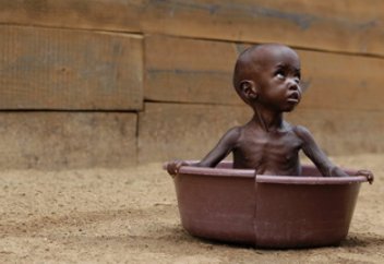 Әр бес секунд сайын бір бала көктей солады