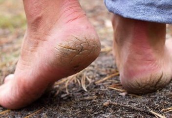 Сусамырдың ерекше белгісі айтылды