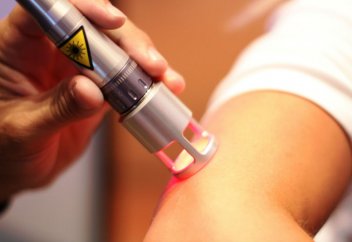 Лазерлік терапия кезінде ораза ұстауға бола ма?