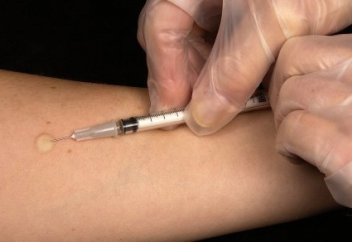 Медики рассказали о "новой" форме туберкулеза в Казахстане