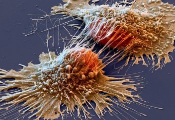 Қатерлі ісікті емдеуге қатысты екі жаңалық