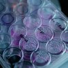 Микропластик обнаружен в репродуктивных жидкостях человека