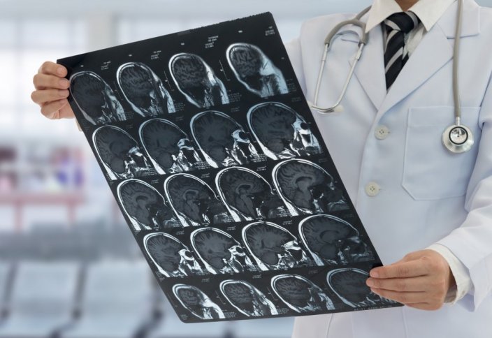 Искусственный интеллект превзошел врачей в диагностике опухолей