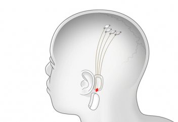 Илон Маск адам миына чип орнататын күннің жақын қалғанын мәлімдеді
