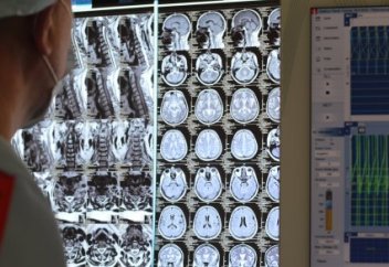 Как лечат пациентов с самой распространенной опухолью мозга в Президентской клинике