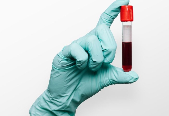 Үйленбей тұрып болашақ жарынан жұқпалу аурудың бар-жоғын анықтау мақсатында тексерілуін талап ете ала ма, әлде тағдырға қарсы шуғу ма?