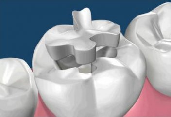 Действительно ли полное омовение (гусуль), если на зубах стоят пломбы?