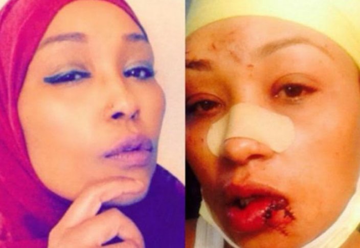 Сограждане собрали деньги на лечение мусульманки, пострадавшей от нападения