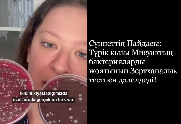 Генетика саласының маманы Мисуактың антибактериалды қасиетін анықтады