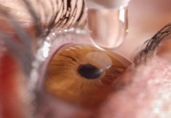 Көз ауруларының еміне қатысты 4 жаңалық