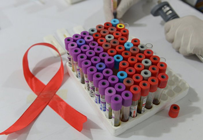 ВИЧ-ке қарсы екпе қанша жылдан кейін егіле бастайды