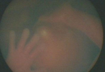 Дәрігер ана құрсағындағы баланы ультрадыбыс арқылы көргенде өз көзіне өзі сенбеді (ВИДЕО)