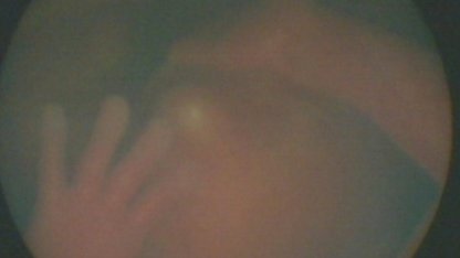 Дәрігер ана құрсағындағы баланы ультрадыбыс арқылы көргенде өз көзіне өзі сенбеді (ВИДЕО)