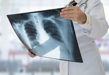 В Великобритании начал распространяться новый смертельный вирус