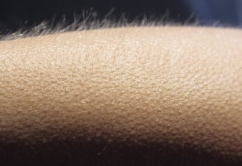 Тарихта тұңғыш рет діңгекті жасушадан түгі мен жүйке талшығы бар адам терісі өсірілді (фото)