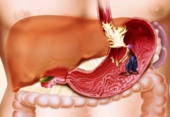 Ішек тазалау әдістері