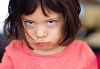 Что такое синдром стервозного лица и как с этим жить