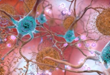 Как умирают клетки мозга (видео)