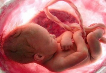 Дәрігерлер ота жасау үшін сәбиді анасының құрсағынан шығарып, кейін қайта салып қойды