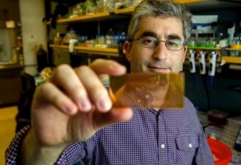 Ғалымдар сусамыр дертін анықтайтын микрочип ойлап тапты