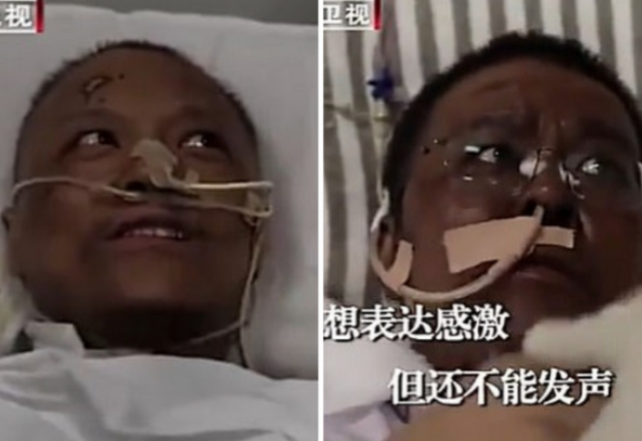 Почерневший от COVID-19 врач начал светлеть (фото). Робот Amazon убивает коронавирус ультрафиолетом (видео)