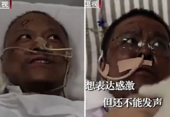 Почерневший от COVID-19 врач начал светлеть (фото). Робот Amazon убивает коронавирус ультрафиолетом (видео)